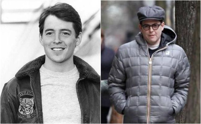 antes e depois matthew broderick