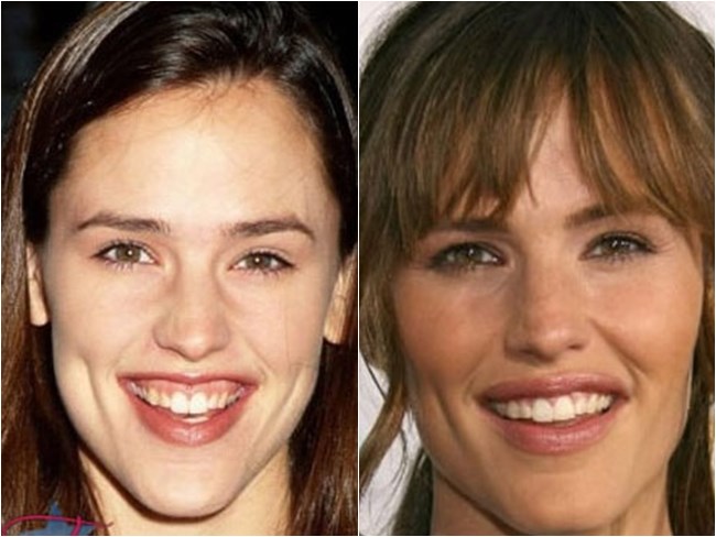 preenchimento boca jennifer garner