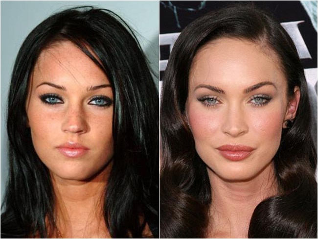 preenchimento boca megan fox