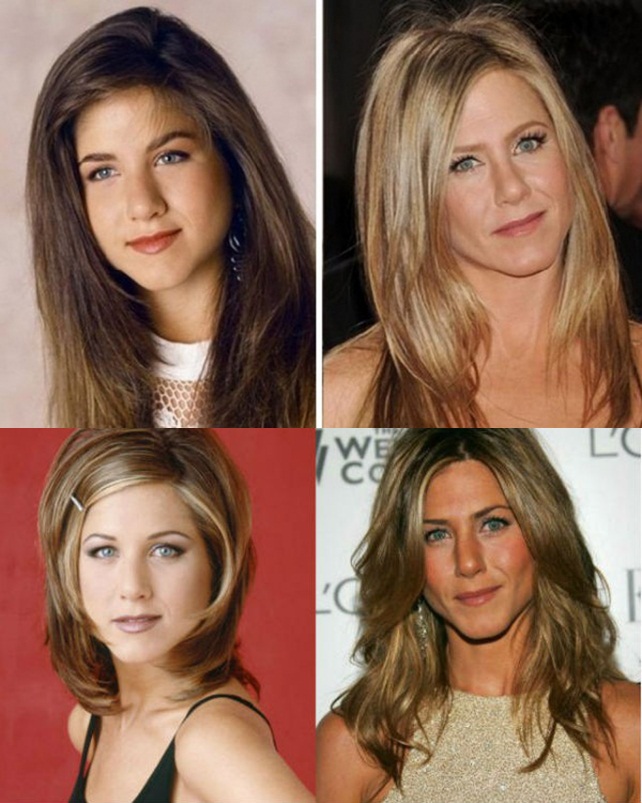 bichectomia jen aniston