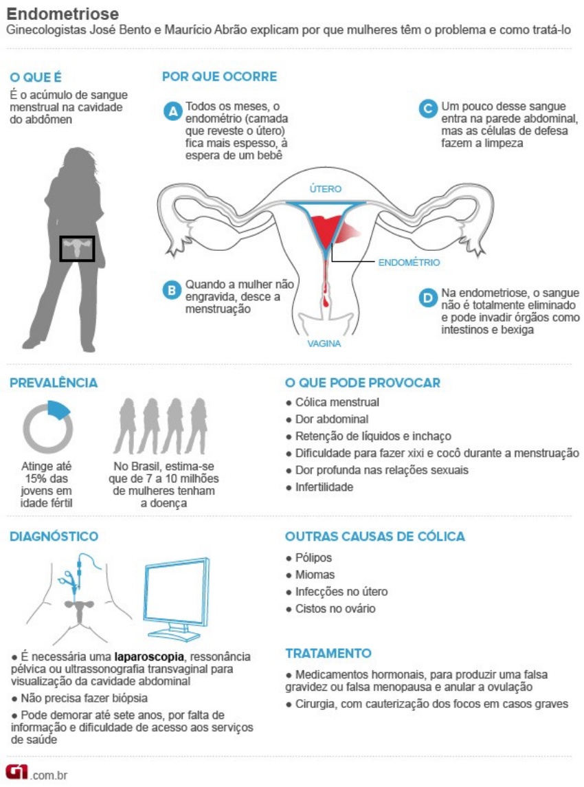 Sintoma De Endometriose Sangue Menstrual Com Coágulos Sanguíneos